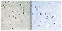 ANKRD20 Polyclonal Antibody