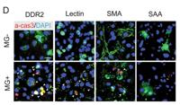 DDR2 Polyclonal Antibody