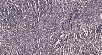 DDX19B Polyclonal Antibody