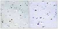 DDX24 Polyclonal Antibody