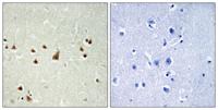 ANKRD26 Polyclonal Antibody