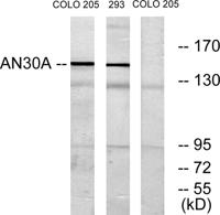 ANKRD30A Polyclonal Antibody