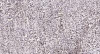 ANKRD30A Polyclonal Antibody