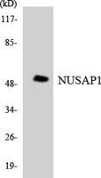 ANKT Polyclonal Antibody