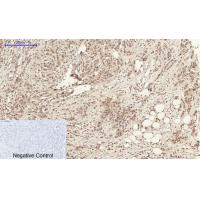 Annexin I Polyclonal Antibody