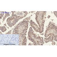 Annexin I Polyclonal Antibody