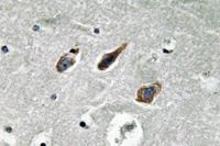 Annexin II Polyclonal Antibody