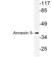 Annexin II Polyclonal Antibody
