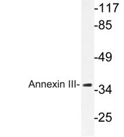 Annexin III Polyclonal Antibody