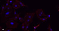 Annexin VI Polyclonal Antibody