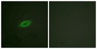 Annexin VI Polyclonal Antibody