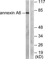 Annexin VI Polyclonal Antibody