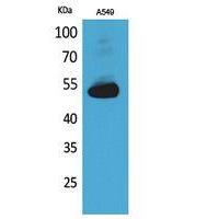 Annexin VII Polyclonal Antibody