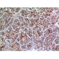 Annexin VII Polyclonal Antibody