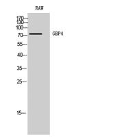 GBP4 Polyclonal Antibody