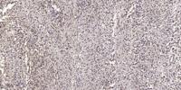GBP5 Polyclonal Antibody