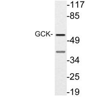 GCK Polyclonal Antibody