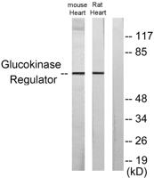 GCKR Polyclonal Antibody