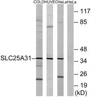 ANT4 Polyclonal Antibody