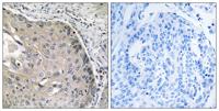 AOX1 Polyclonal Antibody