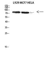 DDX3 Polyclonal Antibody