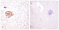 DDX3 Polyclonal Antibody