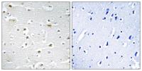 DDX3Y Polyclonal Antibody