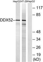 DDX52 Polyclonal Antibody