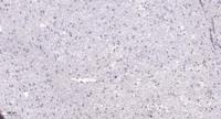 DDX52 Polyclonal Antibody