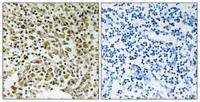 DDX55 Polyclonal Antibody