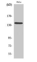 DDX8 Polyclonal Antibody