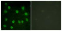 Dematin Polyclonal Antibody