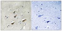 Dematin Polyclonal Antibody