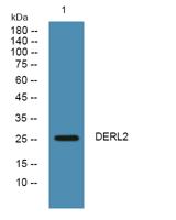 DERL2 Polyclonal Antibody
