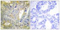Desmin Polyclonal Antibody