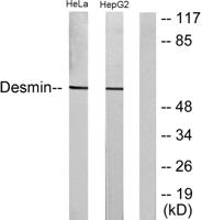 Desmin Polyclonal Antibody