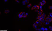 DGK-α Polyclonal Antibody