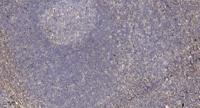 DGK-α Polyclonal Antibody