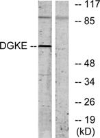 DGK-ε Polyclonal Antibody