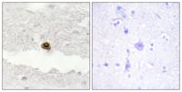 DGK-ζ Polyclonal Antibody