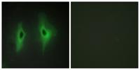 DGK-η Polyclonal Antibody