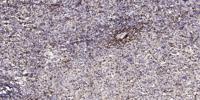 DGK-θ Polyclonal Antibody