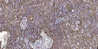 DGK-ι Polyclonal Antibody
