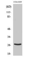 DHRS2 Polyclonal Antibody