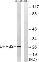 DHRS2 Polyclonal Antibody