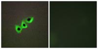 DLC-1 Polyclonal Antibody