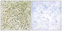 DLC-1 Polyclonal Antibody