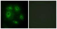 DLEC1 Polyclonal Antibody