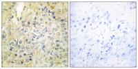DLEC1 Polyclonal Antibody
