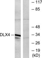 Dlx-4 Polyclonal Antibody